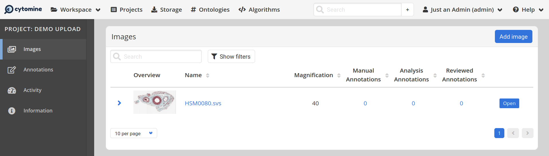 HSM0080.svs file in project after successfull upload